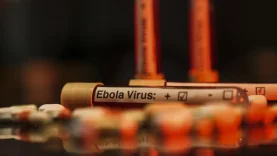 ebola virüs