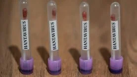 hanta-virus-2459283