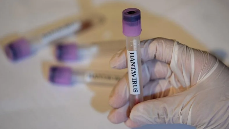 hantavirus-2459284 (1)