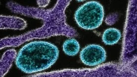 nipah-virusu-getty-2107428