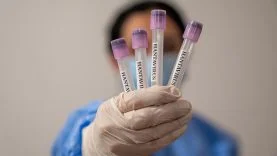 hanta-virus-2459285